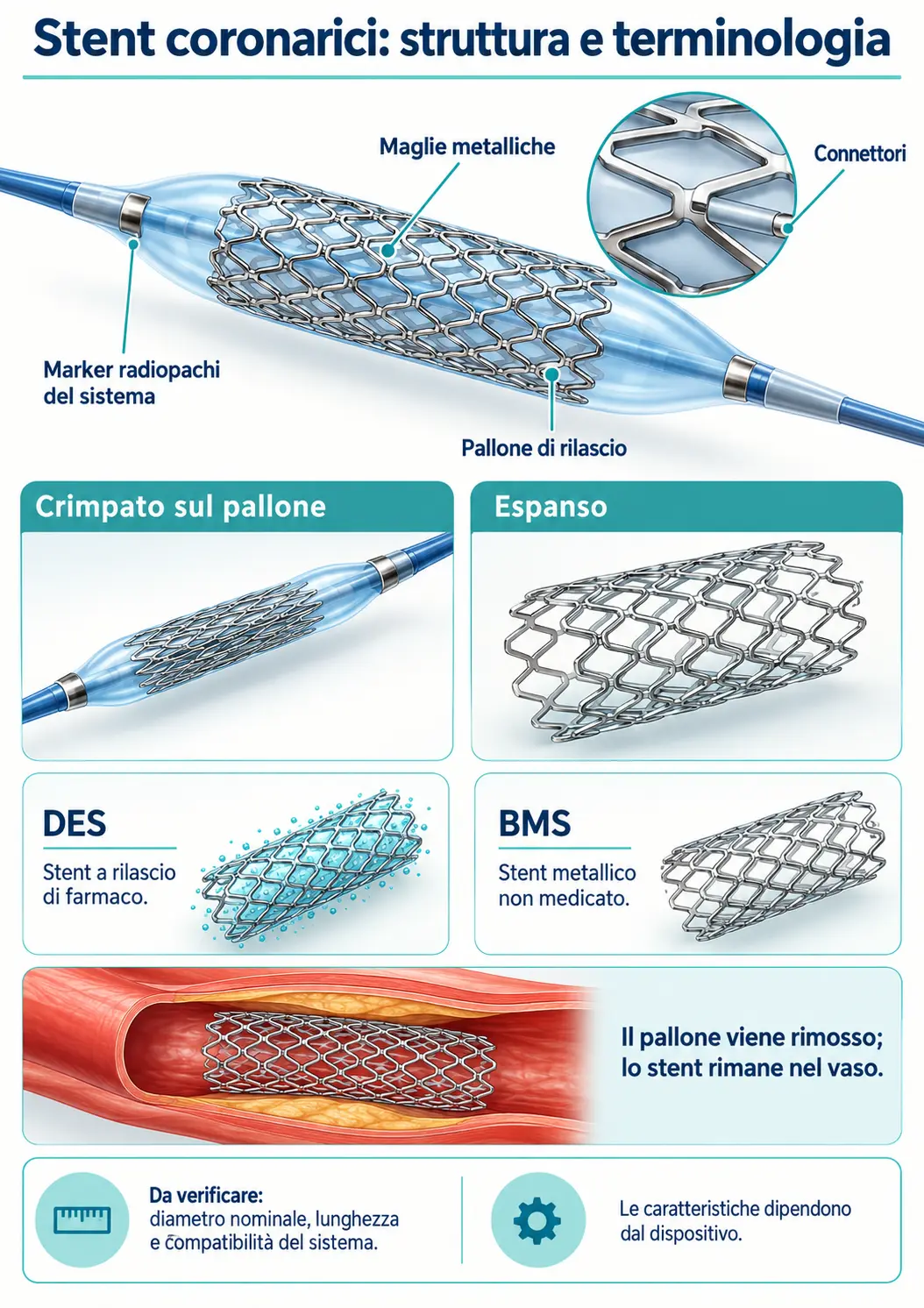Stent coronarici: struttura e terminologia